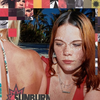 Foto de Sunburn